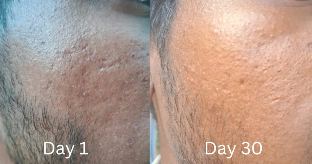 Deconstruct Vitamin C Serum: 1 Month Later, My Honest Opinion