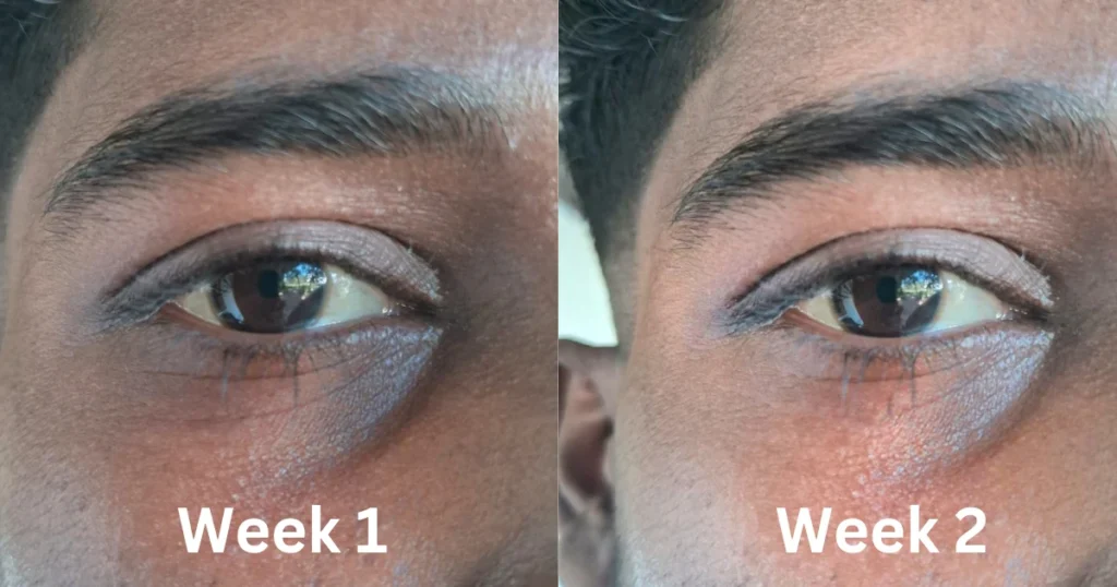2-Week Review: Does Minimalist Vitamin K + Retinal 01% Under Eye Cream Really Work?